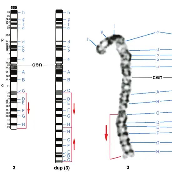 chromosome analysis high resolution, neonatal test